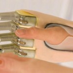  Бионические пальцы ProDigits