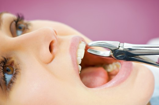 Современное удаление зубов – процесс безболезненный