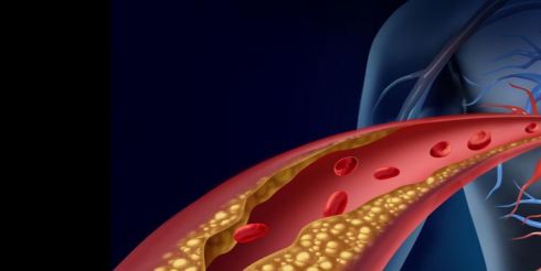 Что такое серрапептаза (серразимаза)