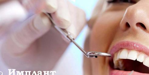 Отзывы пациентов «Имплант Сити»