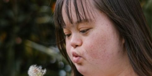 Как научиться жить и взаимодействовать с людьми с синдромом Дауна