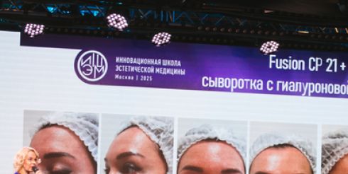 Umetex Aesthetics представила передовые технологии в области косметологии на ИШЭМ-2025