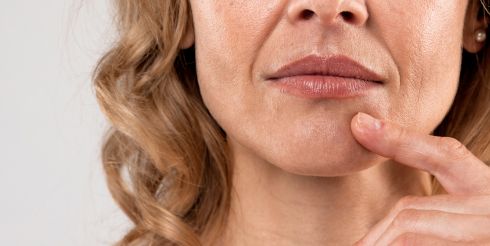 Можно ли устранить глубокие носогубные складки в зрелом возрасте?